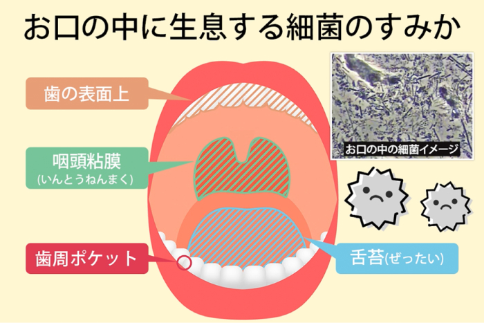 実は、『菌』が原因だったんです...❗